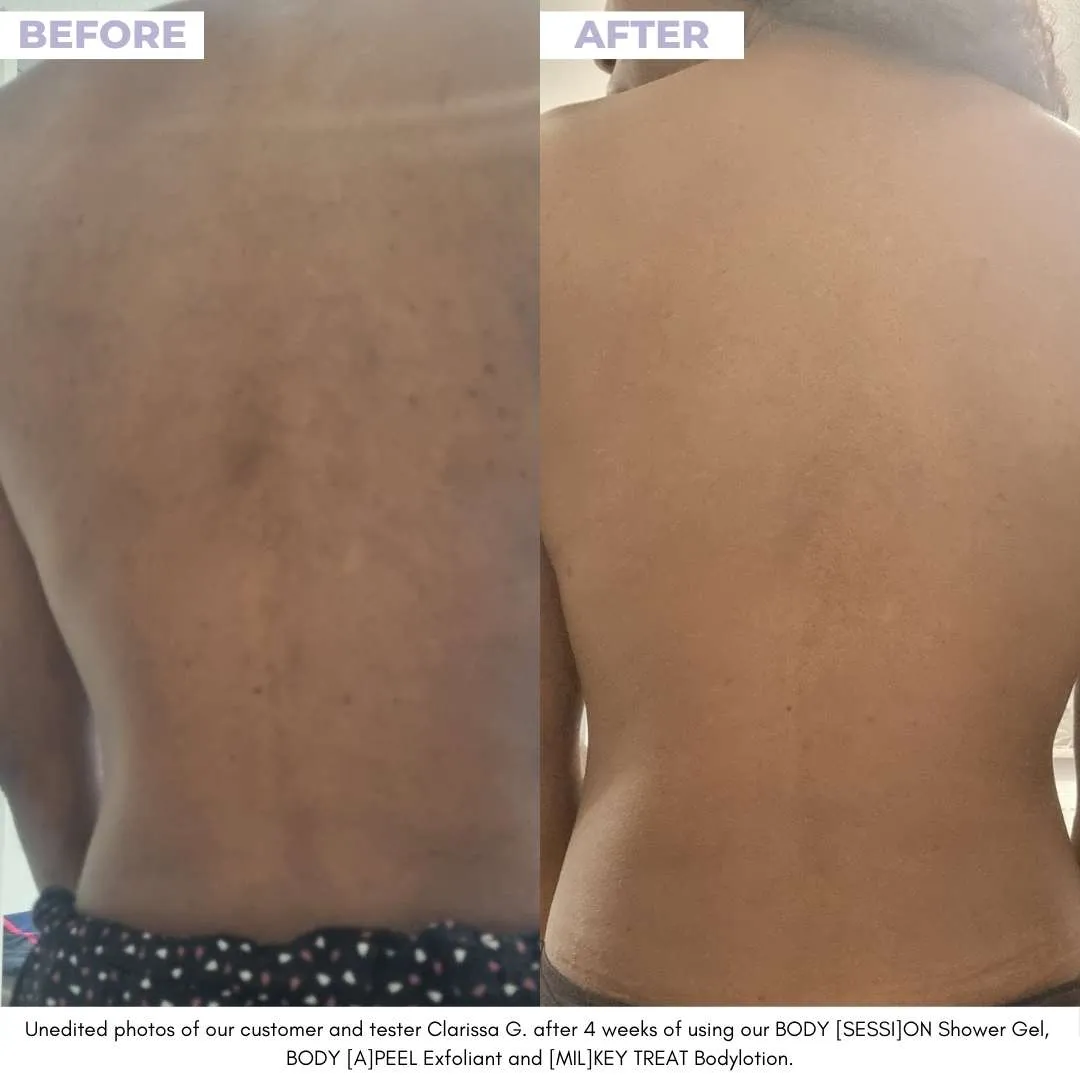 BODY [A]PEEL - Renewing Gel Exfoliant